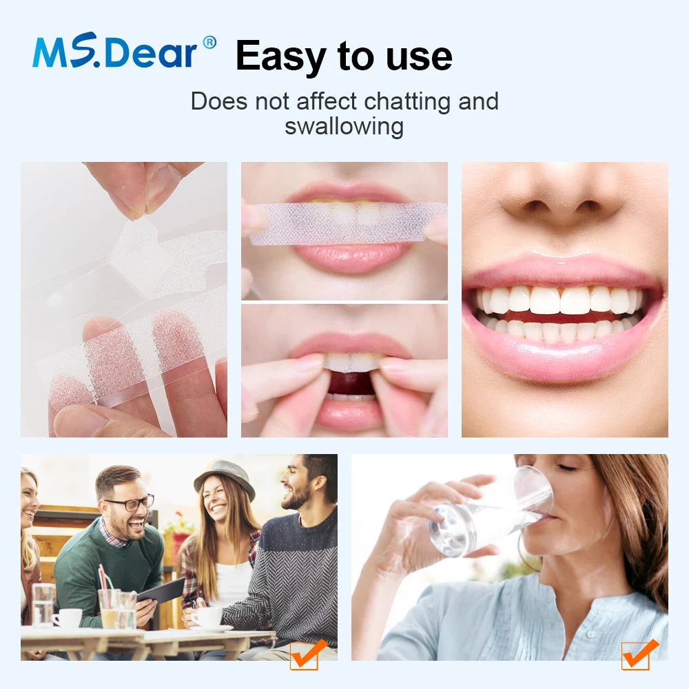 Mint Teeth Whitening Strips – Easy At-Home Oral Care