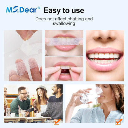 Mint Teeth Whitening Strips – Easy At-Home Oral Care